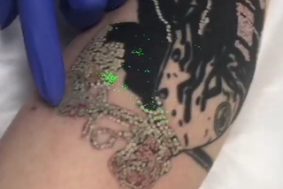 Wnuczka Millera usuwa tatuaże