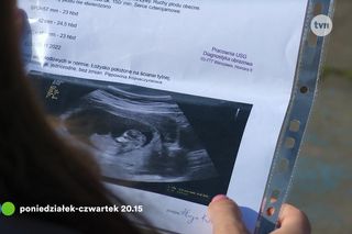 Na Wspólnej odc. 4058: Aneta Siwek (Dorota Krempa)