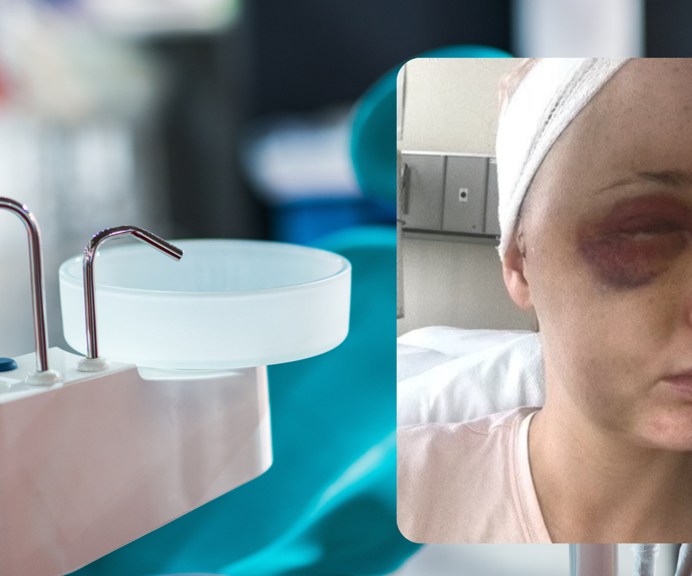 29-latkę bolał ząb, okazało się, że to objaw guza mózgu. Byłam gotowa zaplanować swój pogrzeb