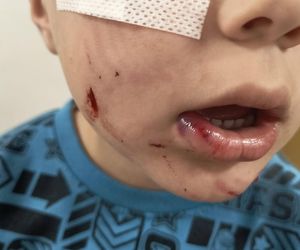 Pogryziony Franek potrzebuje pomocy. Policja szuka właściciela psa. Do szpitala dotarła anonimowa wiadomość