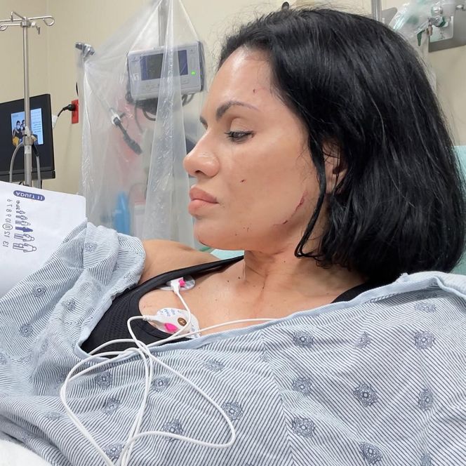 Influencerka kręciła film na Instagrama. Nagle uderzyło w nią auto!