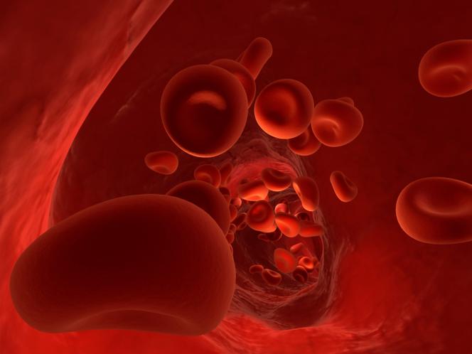 Anemia. Jak się objawia anemia
