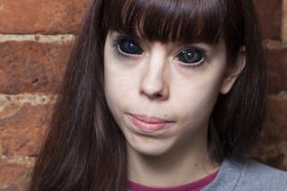 Ola oślepła przez tatuaż oczu. Białka miały być całkiem czarne. Sąd zdecydował: będzie odszkodowanie