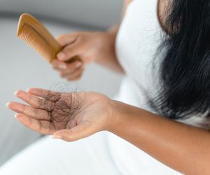 Wypadanie włosów - przyczyny. Jakie choroby powodują łysienie?