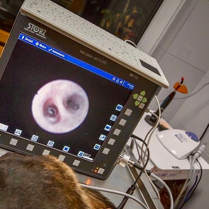 Szukali kości w gardle