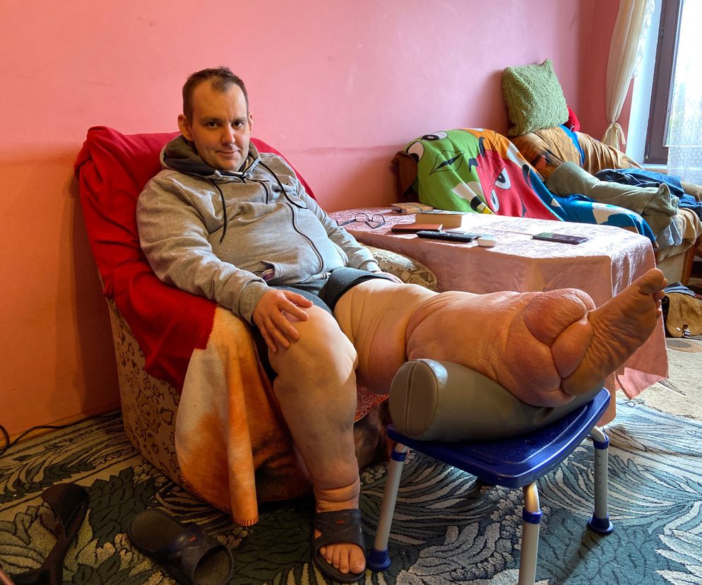 Paweł Kitlas (39 l.) z Białegostoku cierpi na tajemniczą chorobę. Lekarze w Polsce nie potrafią mu pomóc