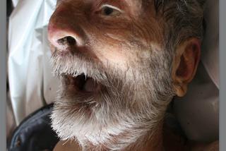 Tajemnicze zwłoki w walizce