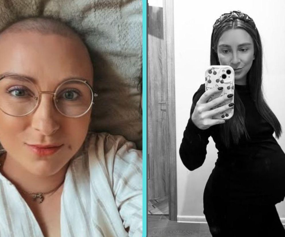 Nicola Zoch, żona Hieronima Zocha, walczy z chłoniakiem Hodgkina