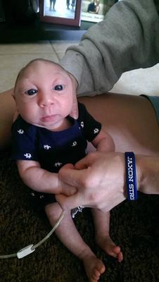 To dziecko ma pół głowy i żyje! Ciężko chory Jaxon wygrał walkę o życie