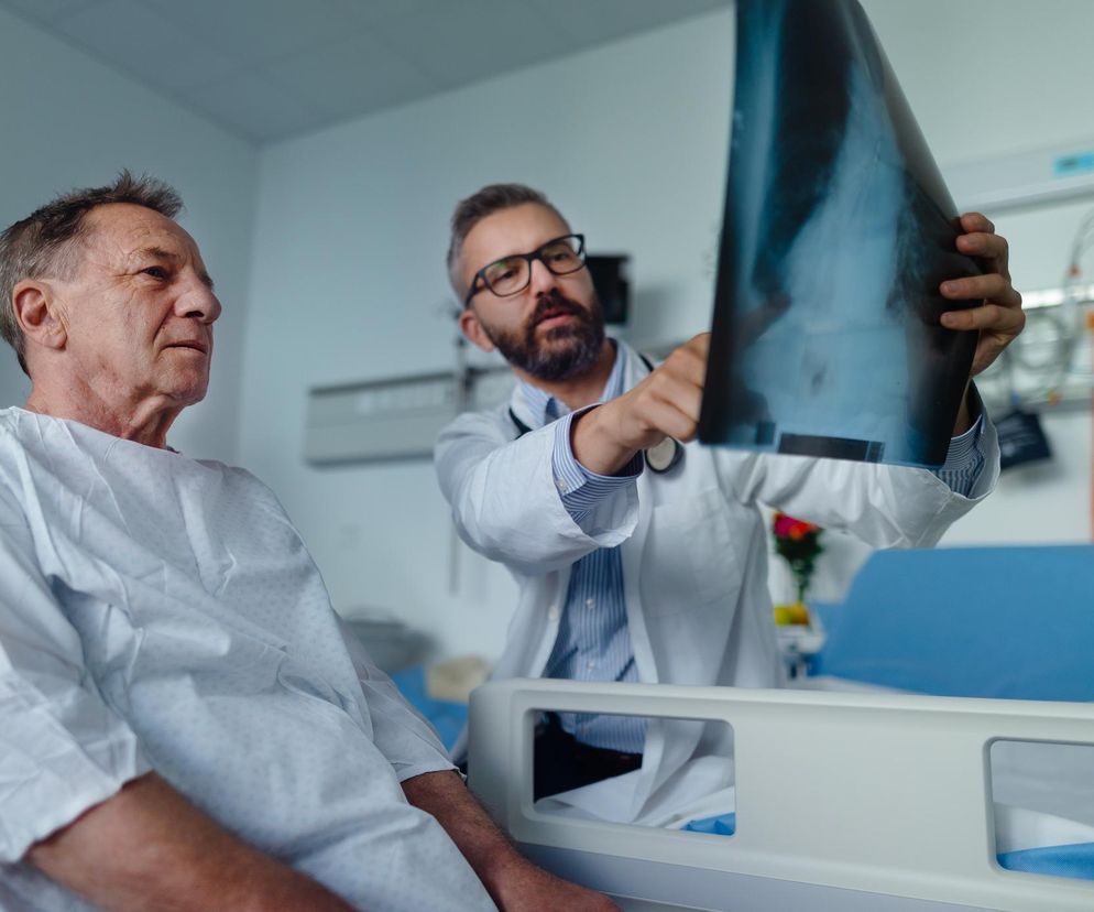 WHO: Gruźlica najczęstszą przyczyną śmierci z powodu choroby zakaźnej