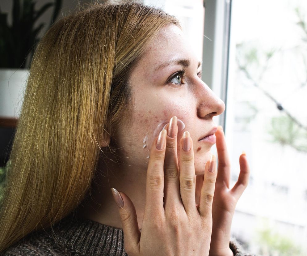 Jak dbać o skórę zimą? Zastosuj 7 sprawdzonych zasad