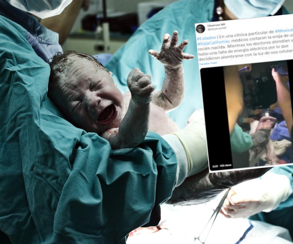 Poród przez cesarskie cięcie