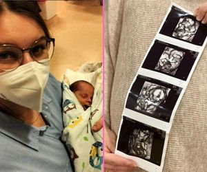 „Mało jest wsparcia”. Rodzice czworaczków spod Poznania szczerze o pomocy państwa 