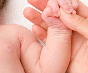 Choroba Rittera - przyczyny, objawy, leczenie