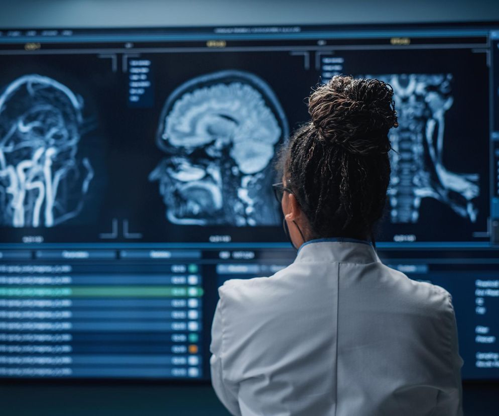 Jak mózg działa w chwili śmierci? Odkrycia neurolożki wprawiają w osłupienie