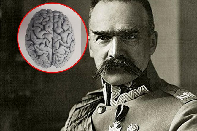 Tajemnica mózgu Piłsudskiego. Nieznany album w archiwach
