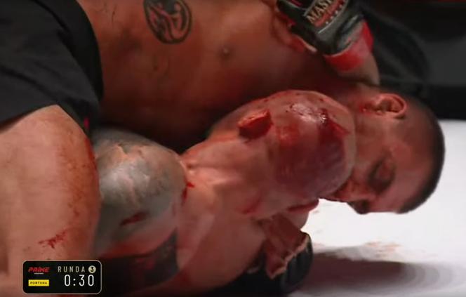 Krwawa rzeź w walce na PRIME MMA