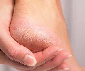 Maść z apteki za 14 zł na stopy to hit wśród Polek. Efekt jak po spa