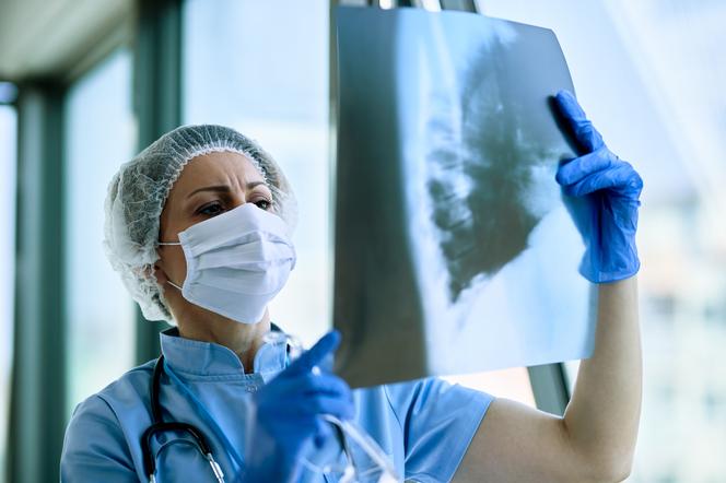 Wirusowe zapalenie płuc dotyka całego układu oddechowego