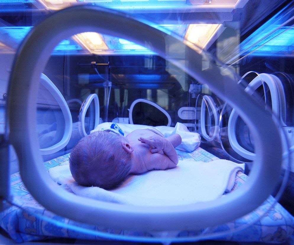 Wielki sukces lekarzy. Usunęli noworodkowi ogromnego guza