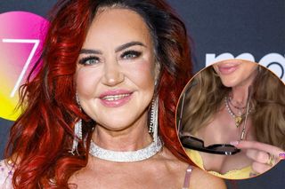 Agnieszka Kotońska pokazała posiniaczoną twarz po operacji. Szokujące wyznanie gwiazdy Gogglebox