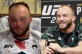 Zmasakrowana twarz polskiej gwiazdy UFC. Aż serce się kraje na ten widok. Mateusz Rębecki poniósł dotkliwą porażkę w oktagonie