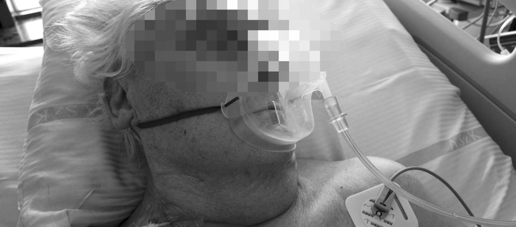 Zmarł, bo lekarz zaszył mu dwie chusty w brzuchu