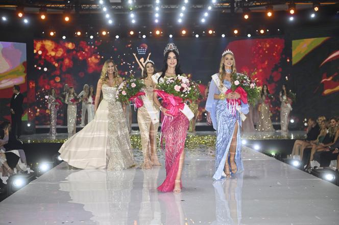 Ewa Jakubiec Miss Polonia 2023 : Pracuję przy przeszczepach włosów