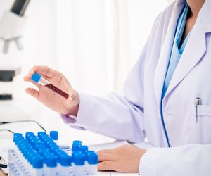 Chromogranina A (CgA) – co to jest? Normy i interpretacja