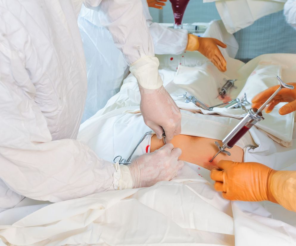 Transplantacja (przeszczep) szpiku kostnego to najskuteczniejsza metoda leczenia białaczki.