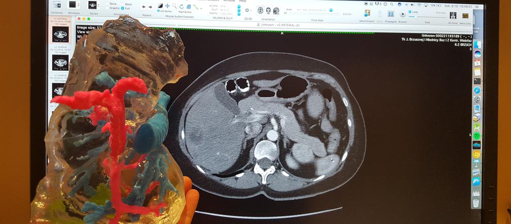 Student UJ drukuje modele wątroby w 3D. To jedyna taka metoda na świecie! [ZDJĘCIA, AUDIO]