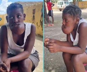15-latka z Angoli żyje z gigantycznym guzem. Lekarze z Olsztyna zaoferowali pomoc