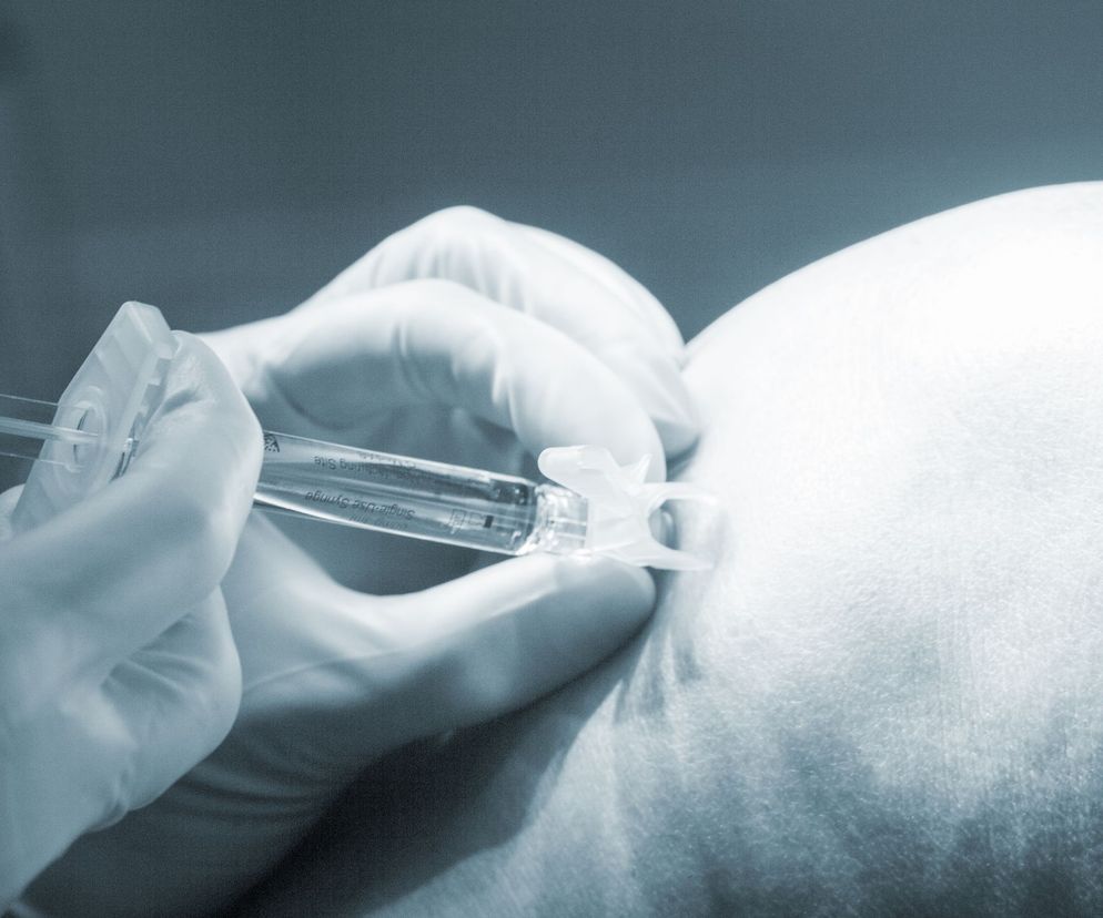 Punkcja kolana to prosty zabieg.