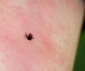 Oto najlepsze domowe sposoby na kleszcze! Zdziwisz się, co może przed nimi ochronić