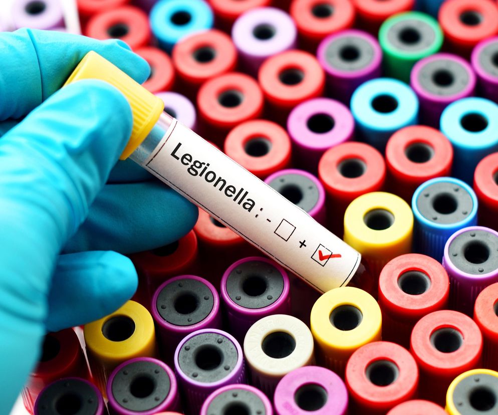 Kto powinien bać się legionelli? Pulmonolog wylicza i wskazuje objawy