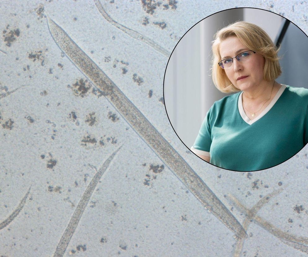 Grzyby kontra nicienie. Naukowcy z UMCS pracują nad preparatami na choroby pasożytnicze