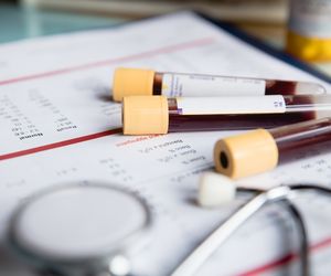 Kiedy zbadać markery nowotworowe?