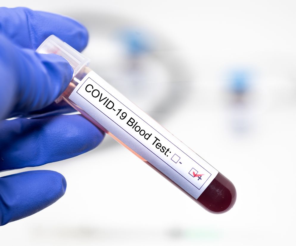 Dłoń w niebieskiej rękawiczce trzyma probówkę z krwią i etykietą COVID-19 Blood Test, symbolizującą badania na obecność koronawirusa. Scena nawiązuje do badań w Narodowym Instytucie Onkologii w Gliwicach, o czym szerzej przeczytasz na Poradnik Zdrowie.