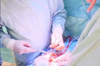 Drut przebił serce 5-letniego Przemka spod Opoczna