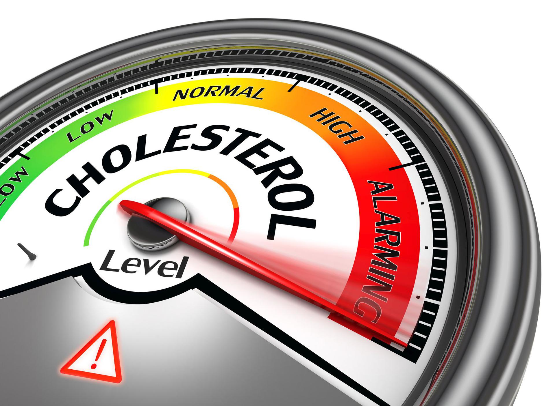 Cholesterol Czym Jest Cholesterol Całkowity Cholesterol Ldl Cholesterol Hdl Jak Obniżyć 8646