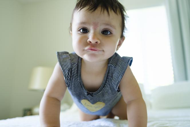 Czy plamki, krostki i naczyniaki na skórze niemowlaka są groźne dla jego zdrowia?