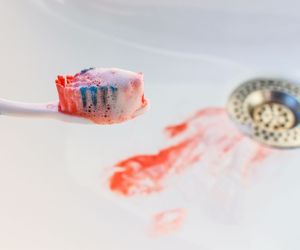 Zapalenie dziąseł: objawy i leczenie