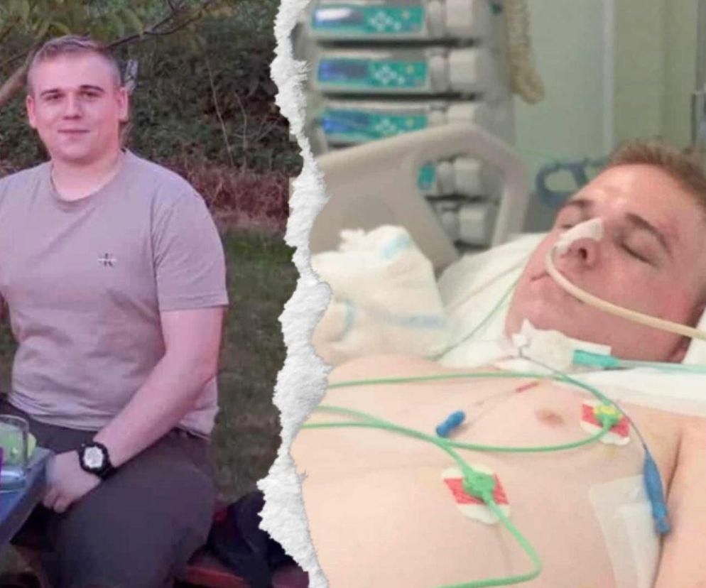 Funkcjonariusz od miesiąca jest na OIOM-ie bydgoskiego szpitala. Swoich nie zostawiamy 