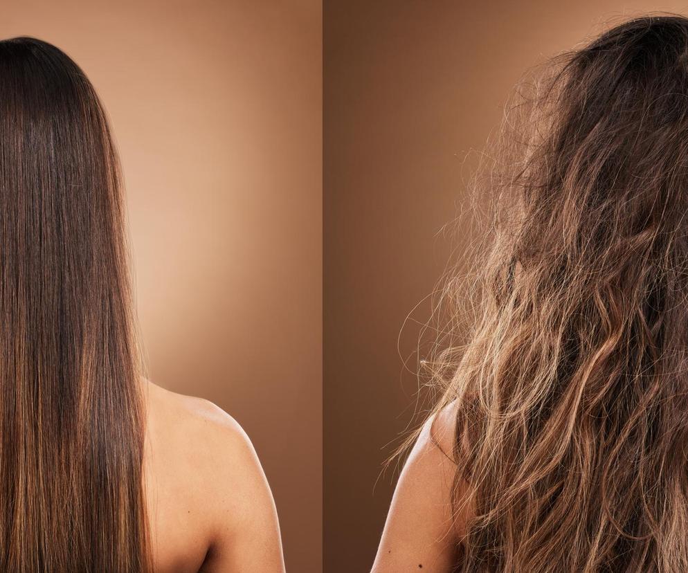 Sposoby na zapuszczanie włosów. Spróbuj tych metod, a afekty mogą zaskoczyć