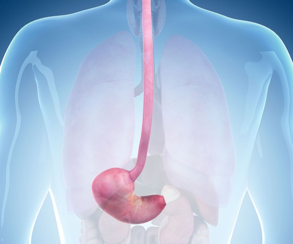 Eozynofilowe zapalenie przełyku to przewlekła choroba przełyku, rozwijająca się na podłożu immunologicznym.