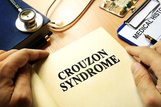 Zespół Crouzona - objawy, przyczyny i leczenie dystozy czaszkowo-mózgowej