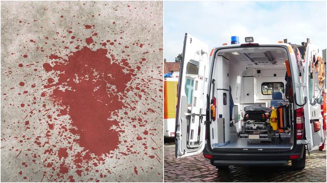 Szedł ulicą, gdy pękła mu żyła! 63-latek spod Mławy omal nie wykrwawił się na śmierć