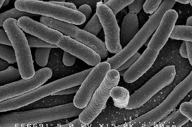 Pałeczka okrężnicy - jak wygląda bakteria E. coli