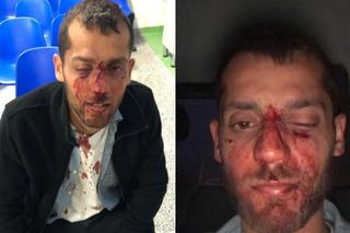 Brutalny atak na studentów z Izraela: policja poszukuje świadków, filmików, zdjęć!