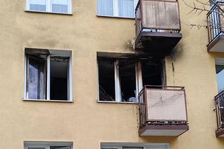 Uratował koty z pożaru, sam walczy o życie 